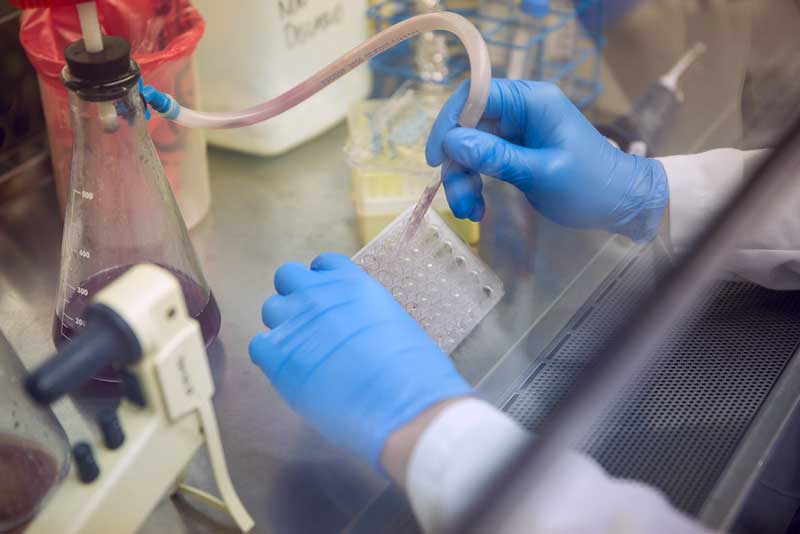 Two hands wearing blue gloves piping a sample into tray in a lab